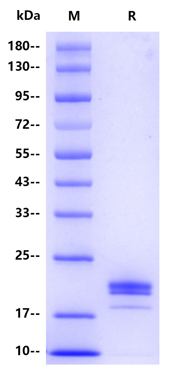Recombinant Human IL-1β Protein(C-10His)