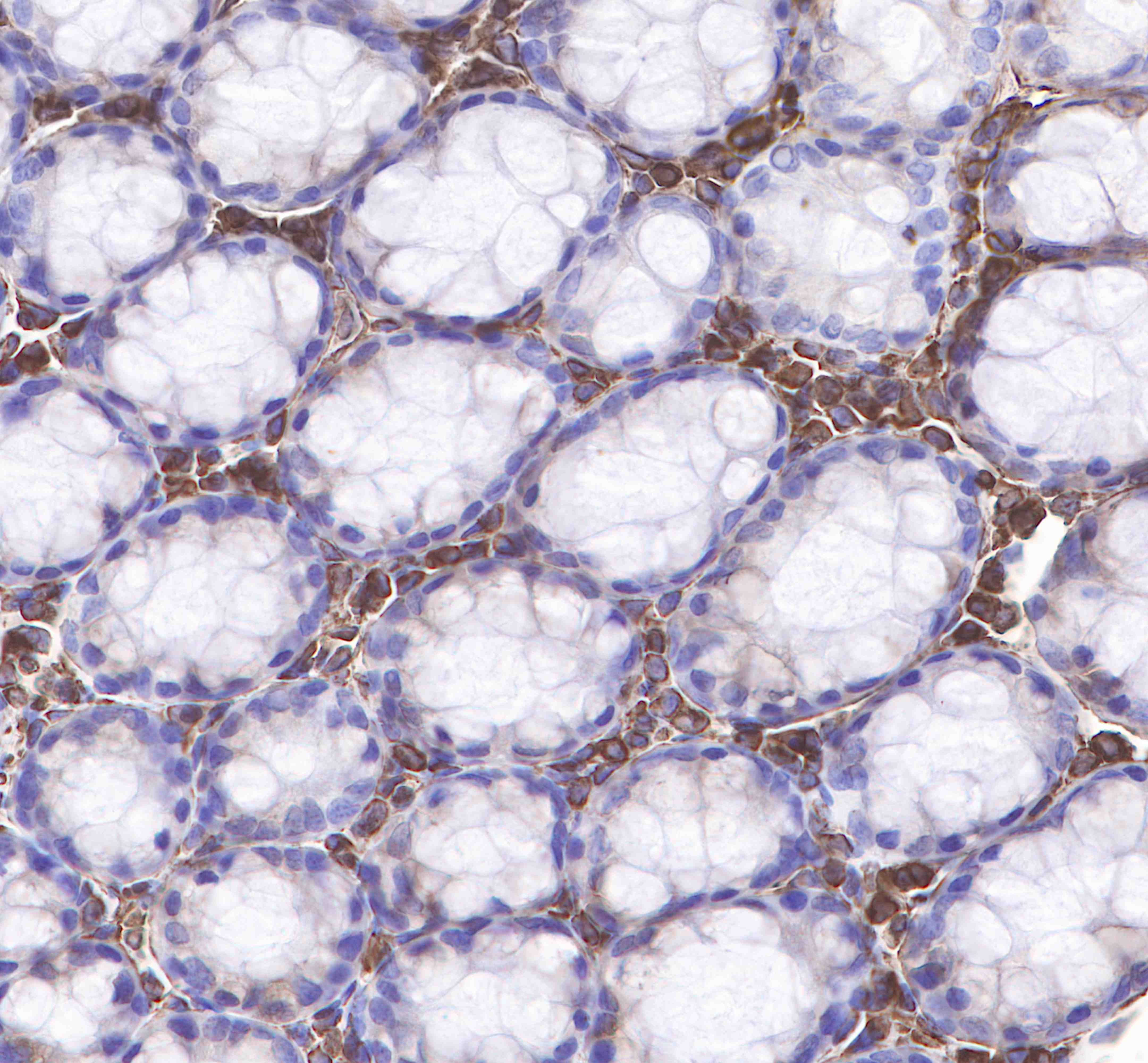 Rabbit anti-Vimentin Monoclonal Antibody(029-20)