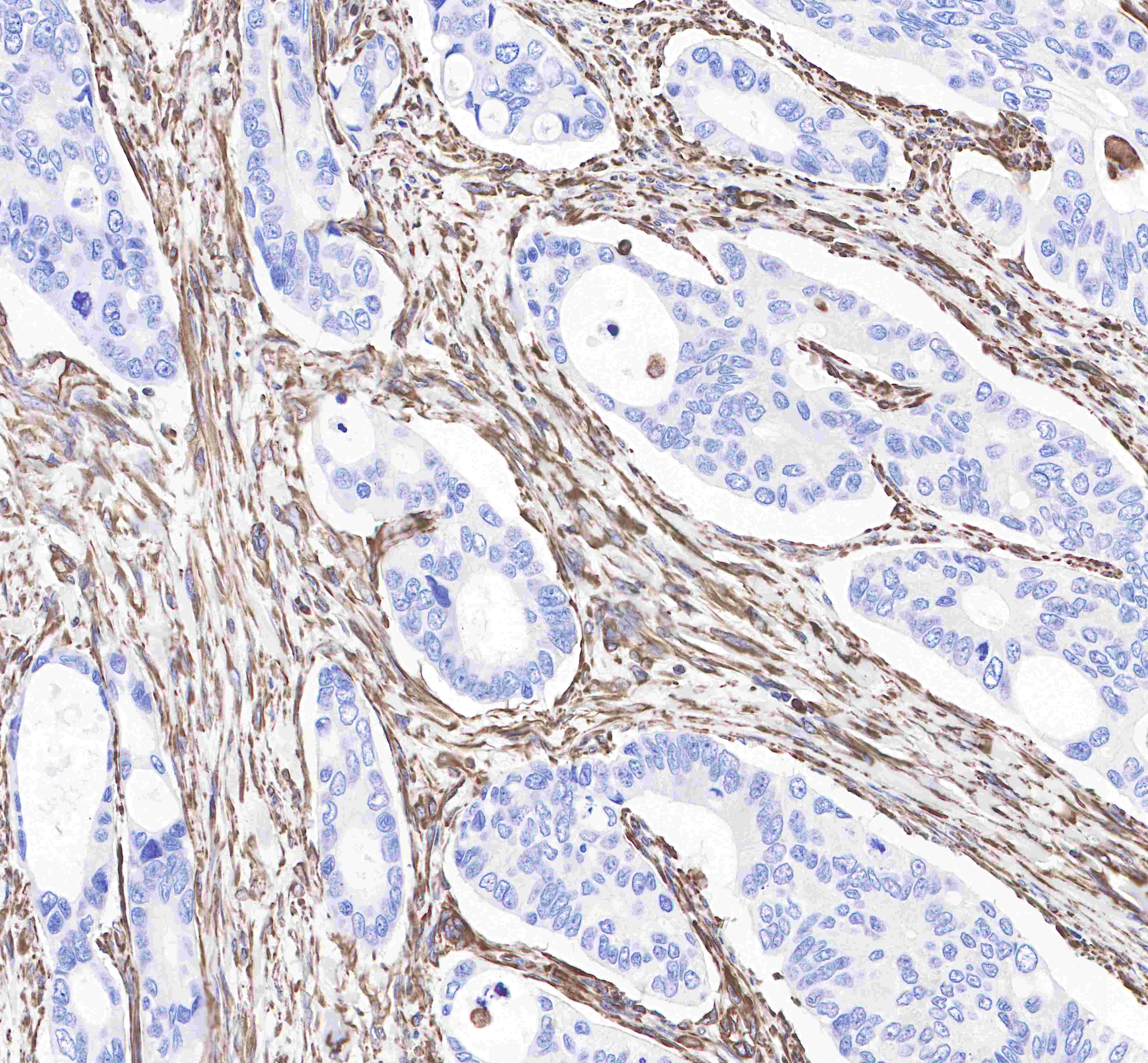 Rabbit anti-Vimentin Monoclonal Antibody(029-20)