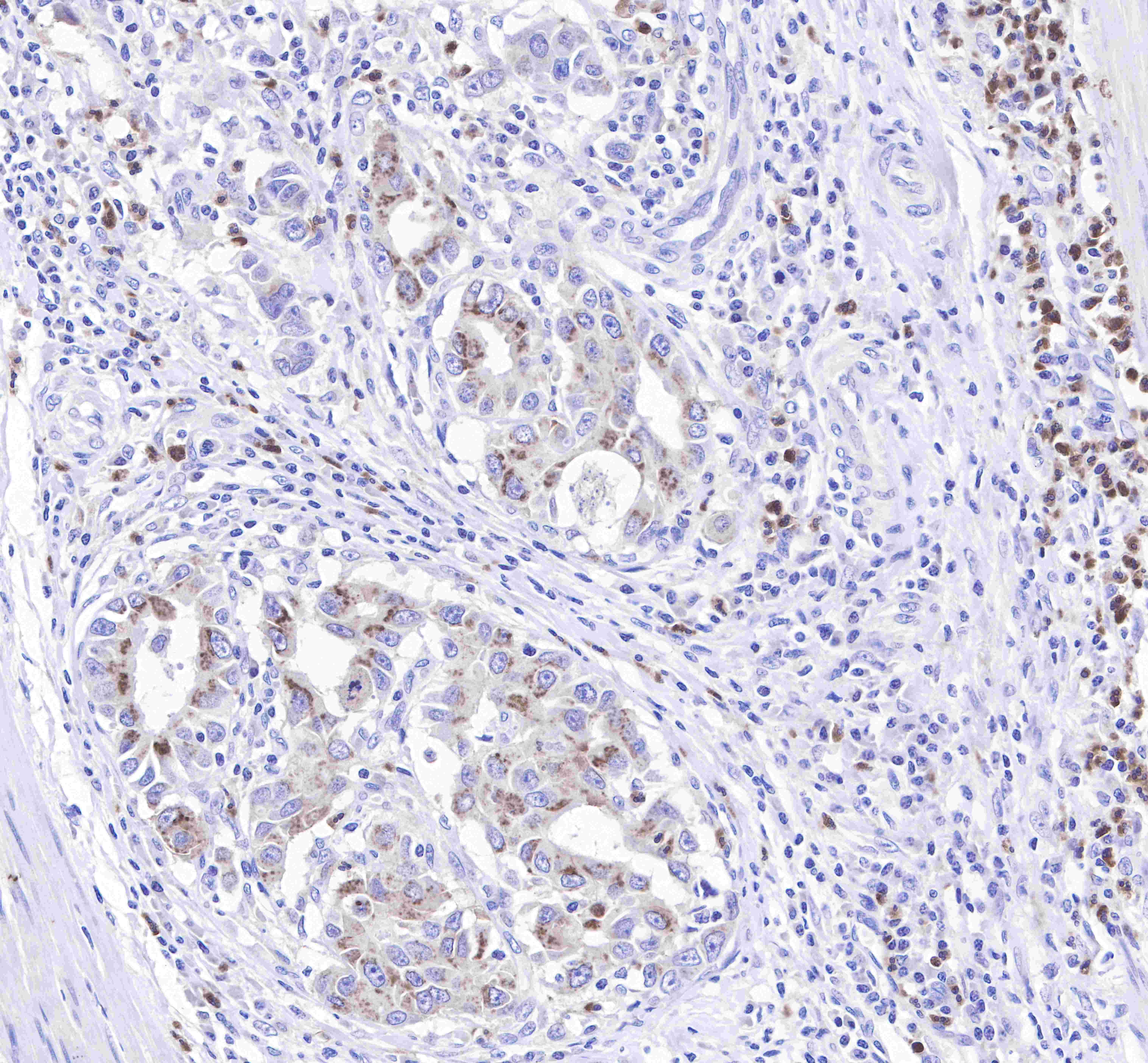 CD15 Recombinant Rabbit mAb (SDT-R009)