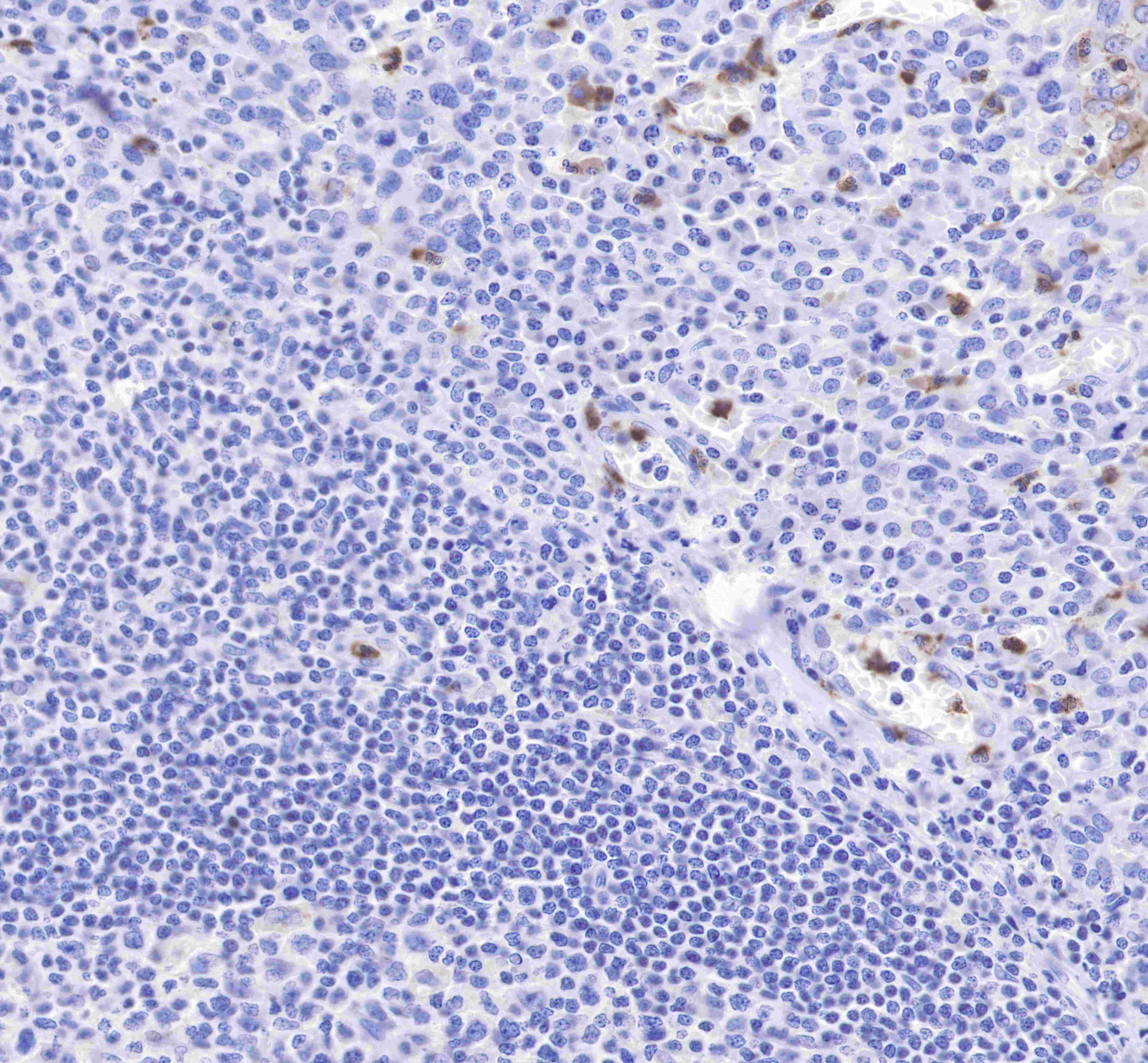 CD15 Recombinant Rabbit mAb (SDT-R009)