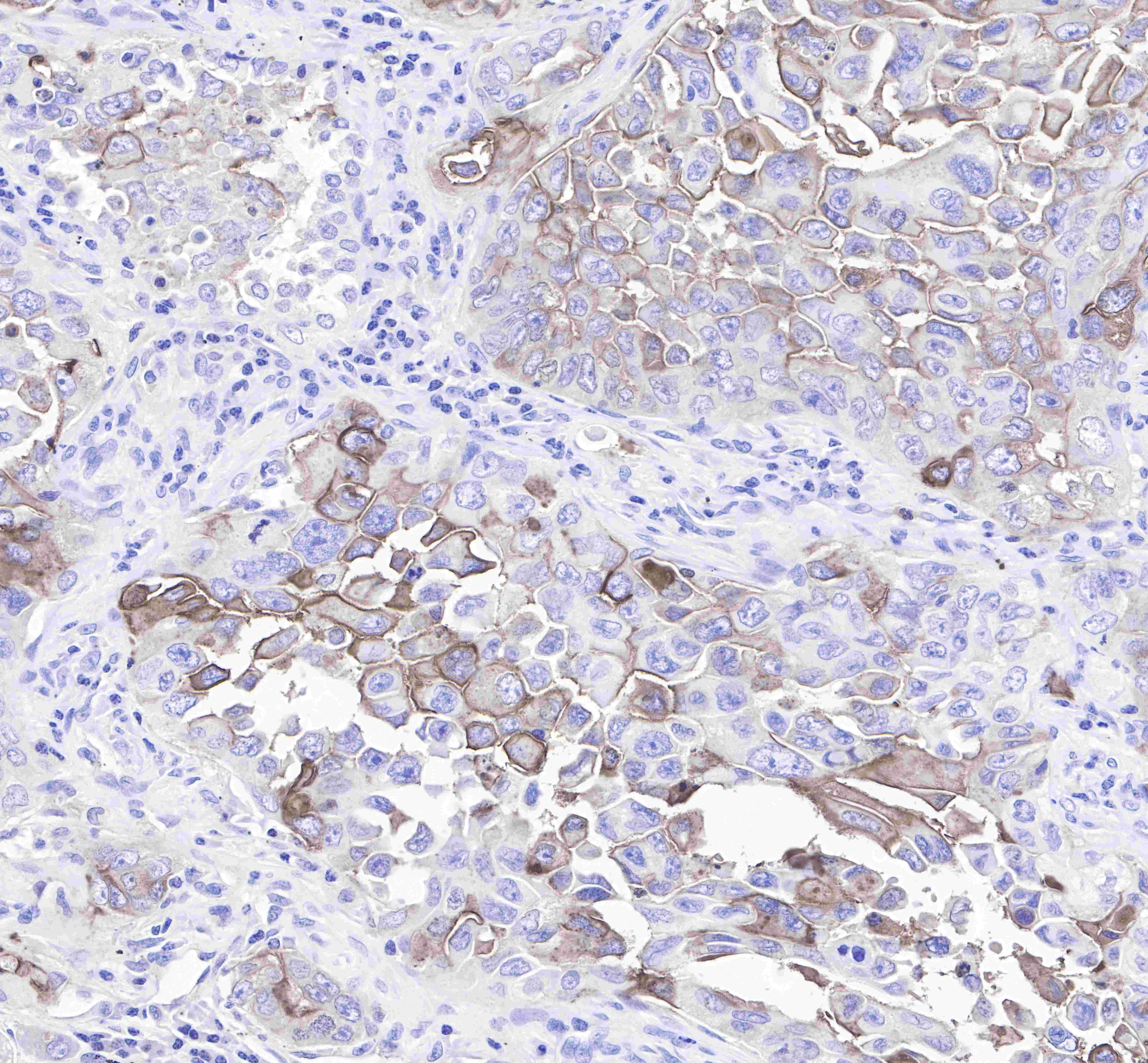 CD15 Recombinant Rabbit mAb (SDT-R009)