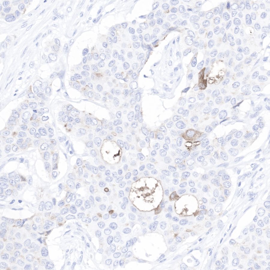 C4d Recombinant Rabbit mAb (SDT-R021)