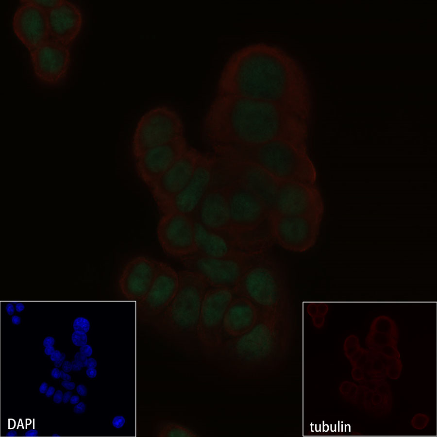 p53 Recombinant Rabbit mAb (SDT-100-72)