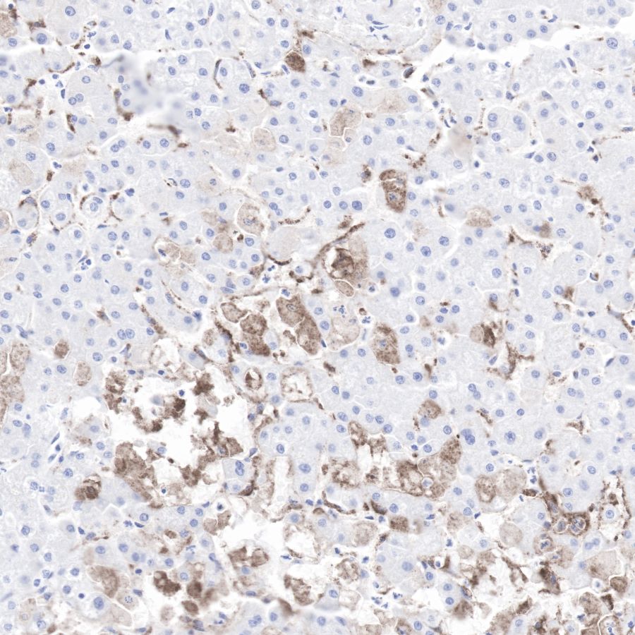 C4d Recombinant Rabbit mAb (SDT-R021)