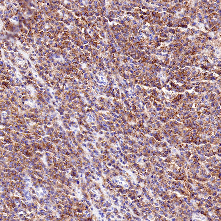 CD40 Recombinant Rabbit mAb (SDT-145-45)