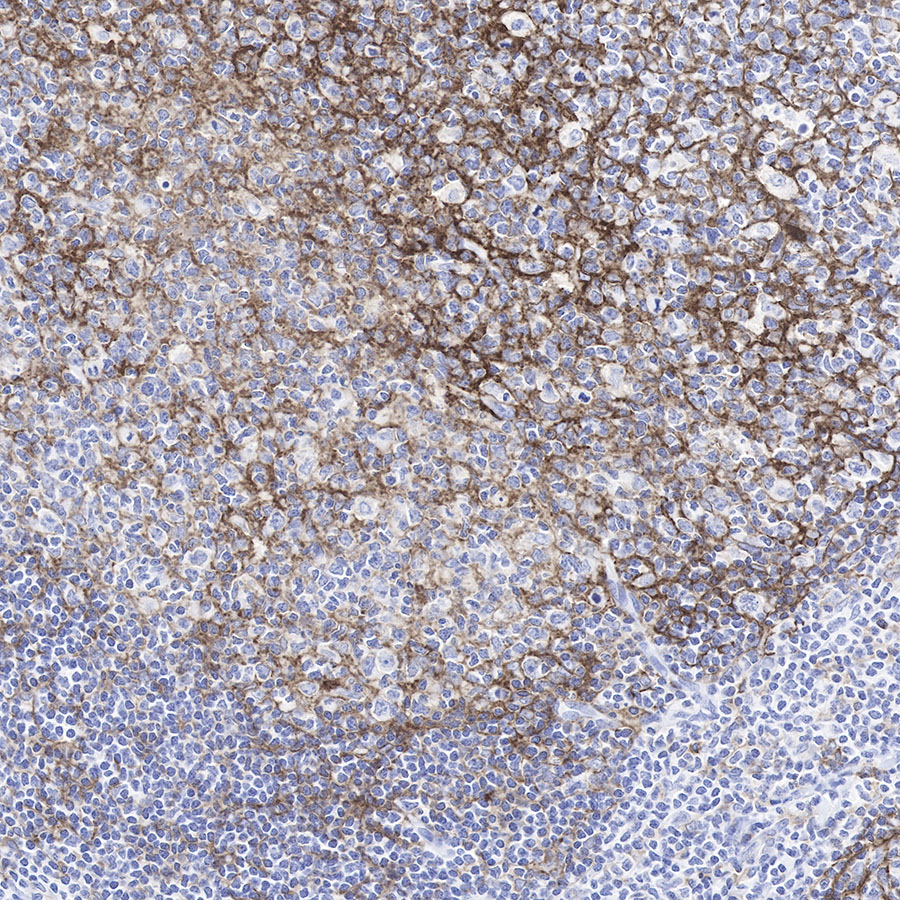 CD11b Recombinant Rabbit mAb (SDT-058-44)