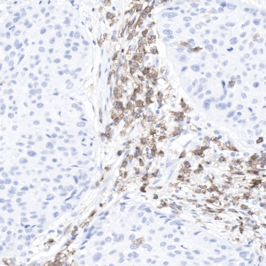 CD11b Recombinant Rabbit mAb (SDT-058-44)