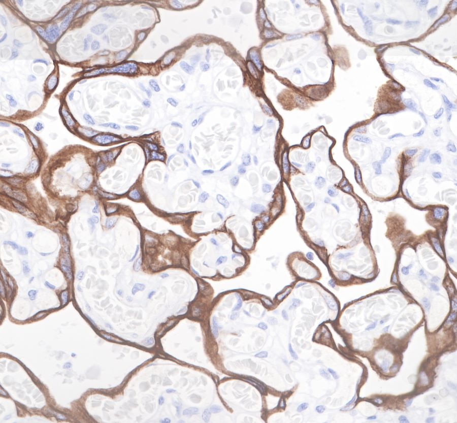Rabbit anti-CytokeRatin 19 Recombiant Monoclonal Antibody(107-19)