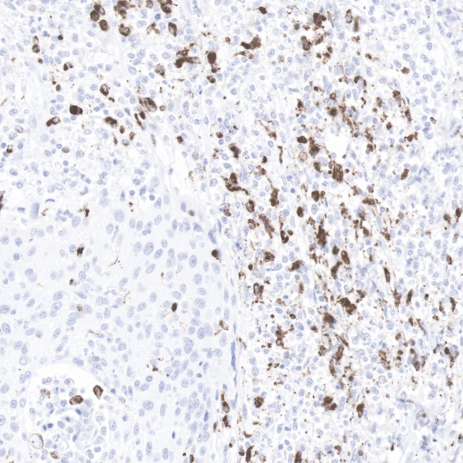Rabbit anti-CD68 Recombinant Monoclonal Antibody(R025)