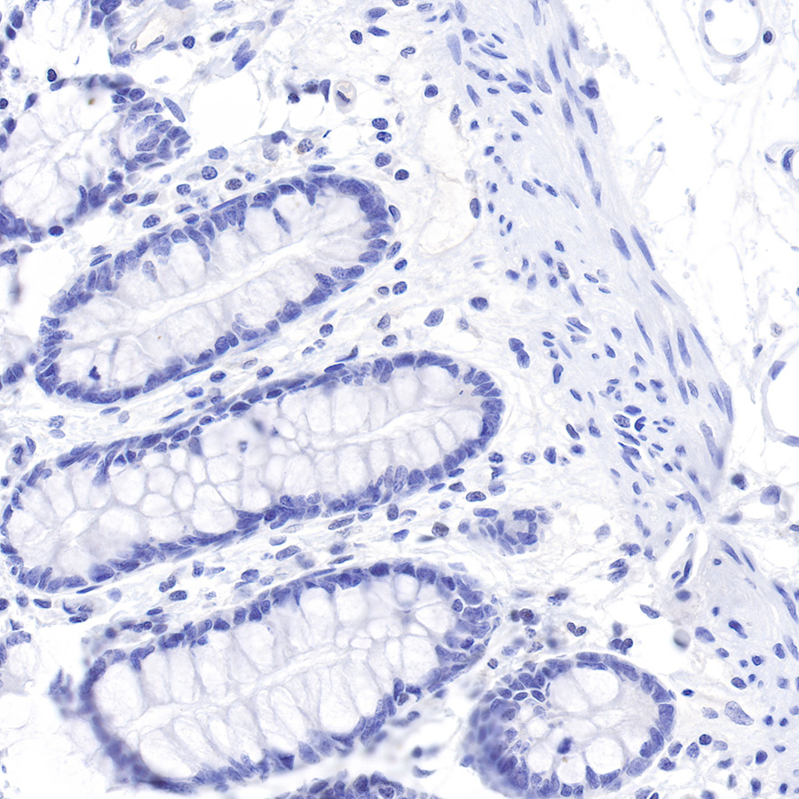 S-RMab® MUC6 Recombinant Rabbit mAb (SDT-081-72)