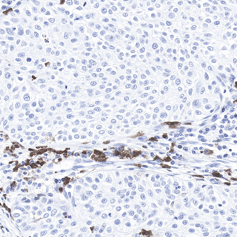 CD11b Recombinant Rabbit mAb (SDT-058-44)
