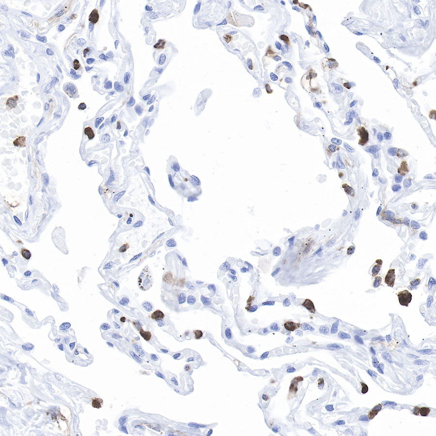 CD11b Recombinant Rabbit mAb (SDT-058-44)