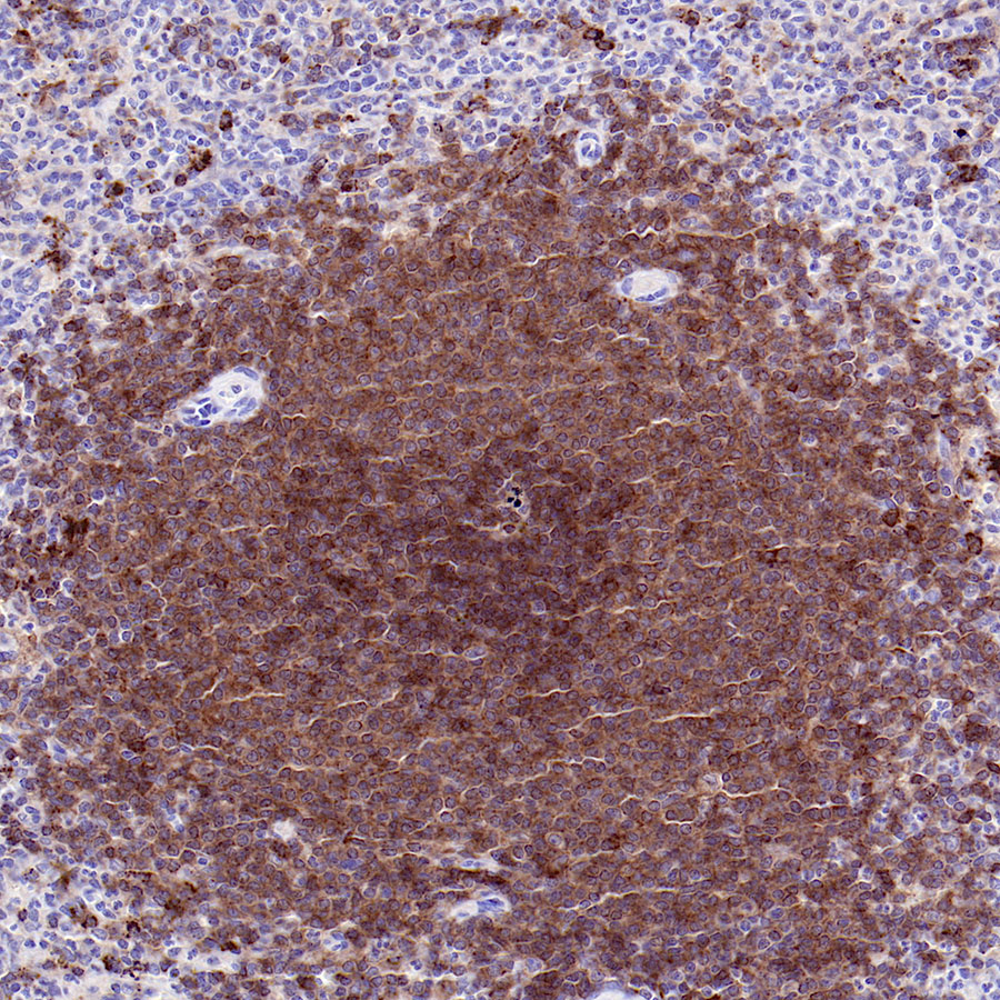 CD40 Recombinant Rabbit mAb (SDT-145-45)