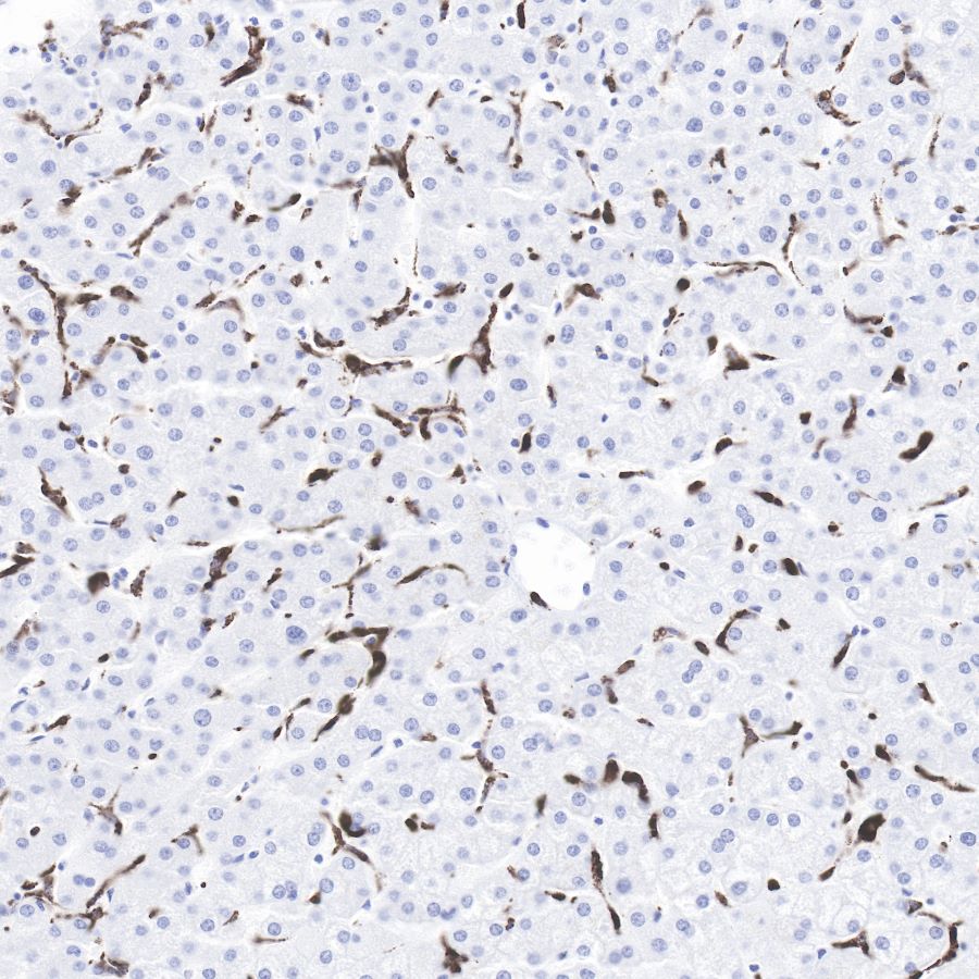 Rabbit anti-CD68 Recombinant Monoclonal Antibody(R025)