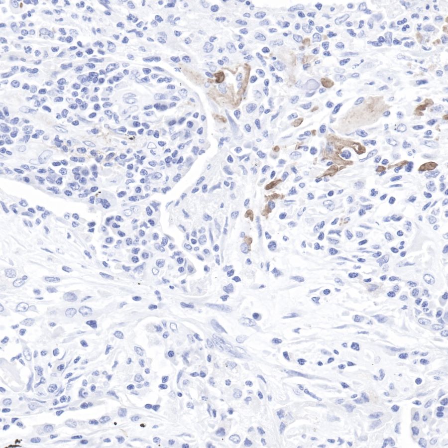 C4d Recombinant Rabbit mAb (SDT-R021)