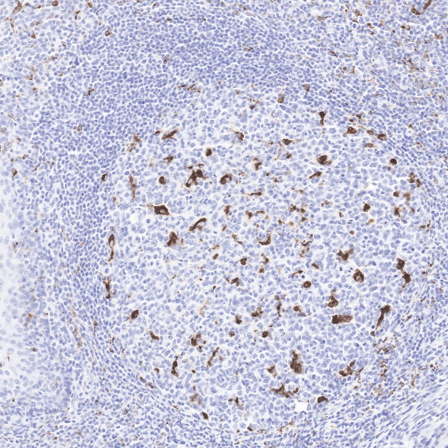 Rabbit anti-CD68 Recombinant Monoclonal Antibody(R025)