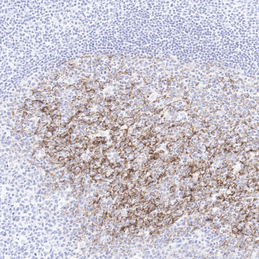 C4d Recombinant Rabbit mAb (SDT-R021)