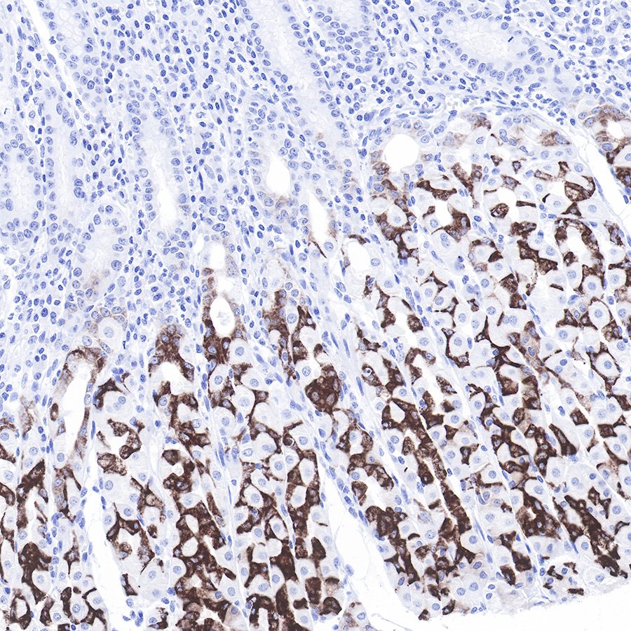 S-RMab® MUC6 Recombinant Rabbit mAb (SDT-081-72)