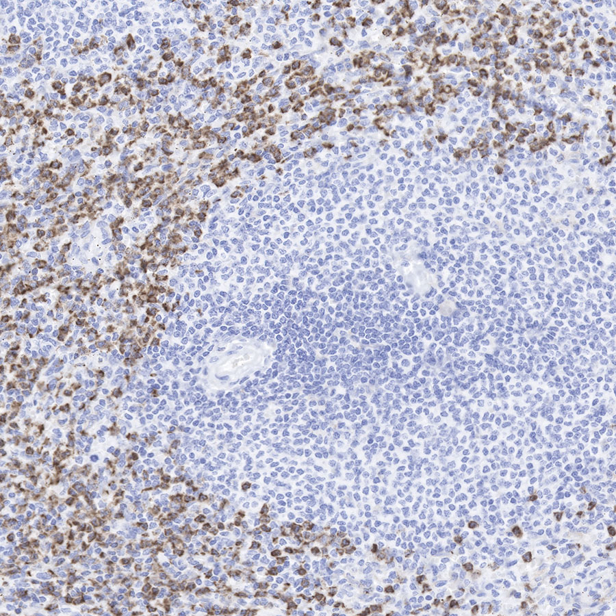 CD11b Recombinant Rabbit mAb (SDT-058-44)