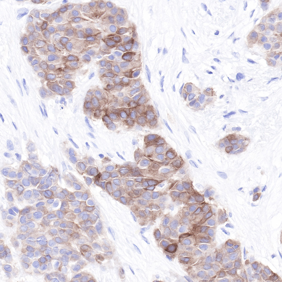 LIV-1/SLC39A6 Recombinant Rabbit mAb,PBS Only (SDT-206-84)