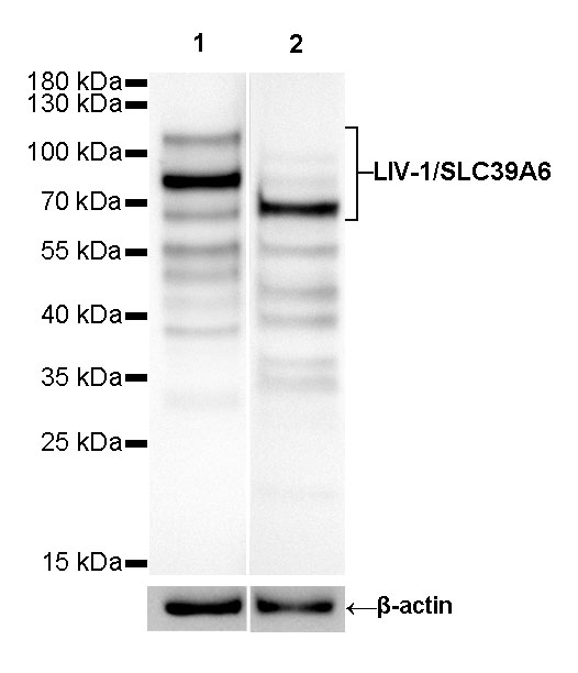 LIV-1/SLC39A6 Recombinant Rabbit mAb,PBS Only (SDT-206-84)