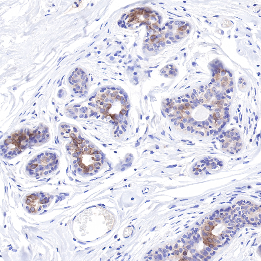 LIV-1/SLC39A6 Recombinant Rabbit mAb,PBS Only (SDT-206-84)