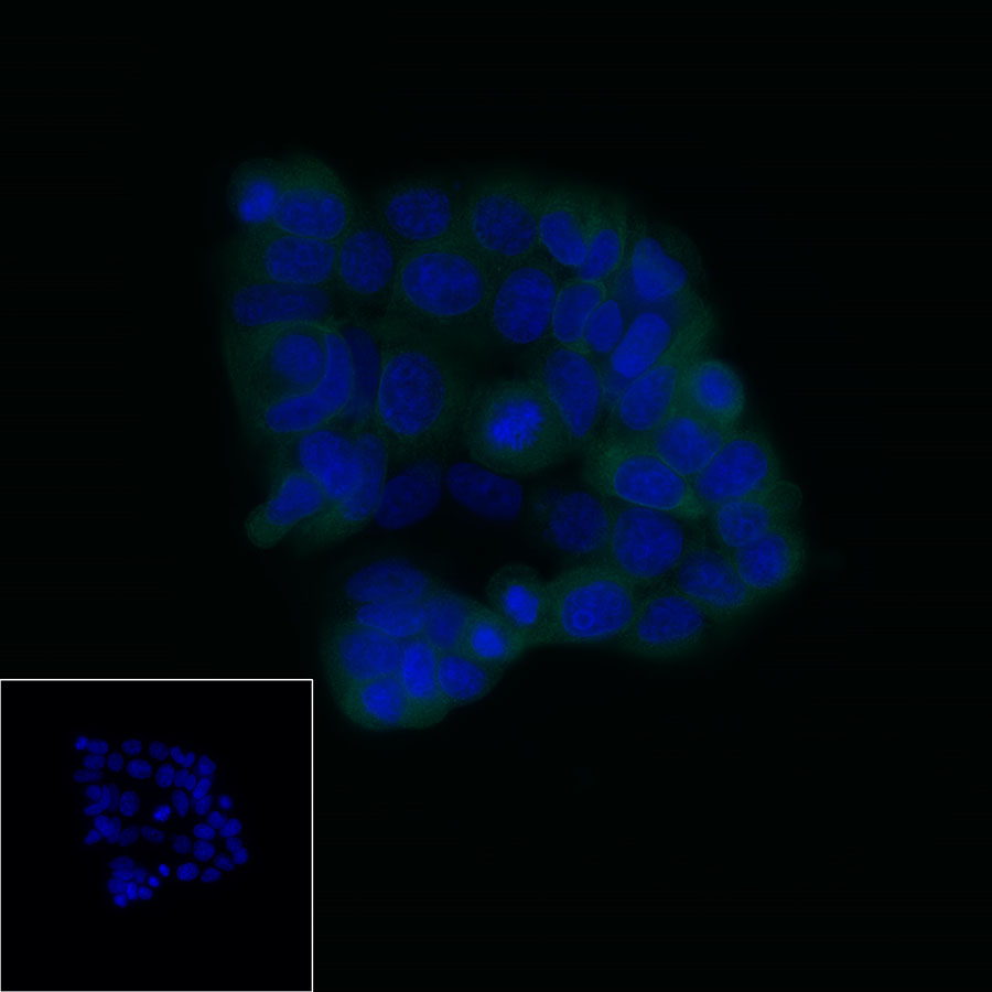 LIV-1/SLC39A6 Recombinant Rabbit mAb,PBS Only (SDT-206-84)