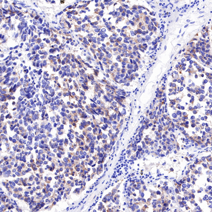 DLL3 Recombinant Rabbit mAb (SDT-207-59)