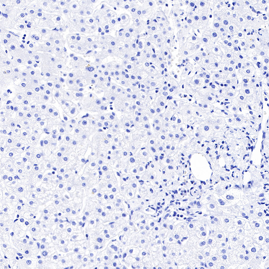 DLL3 Recombinant Rabbit mAb (SDT-207-59)