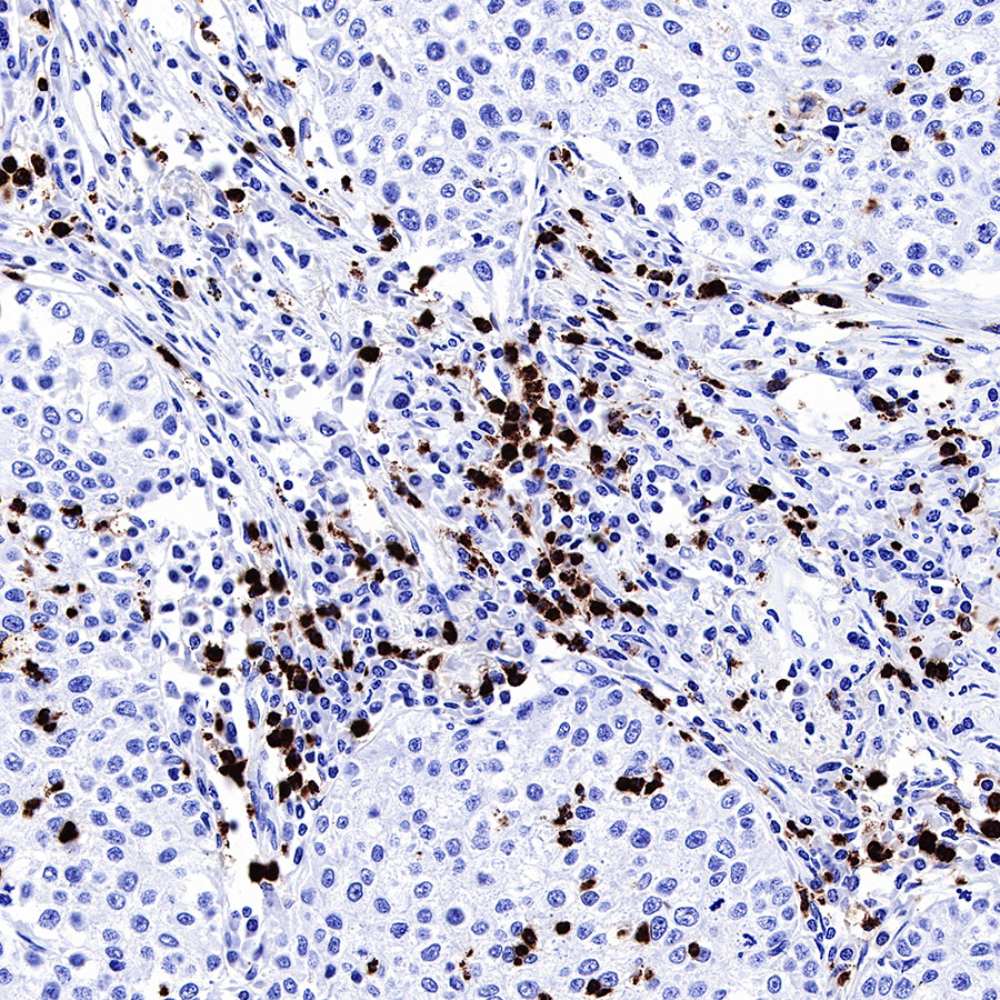 MPO Recombinant Rabbit MAb (SDT-224-19),P05164_Starter Bio