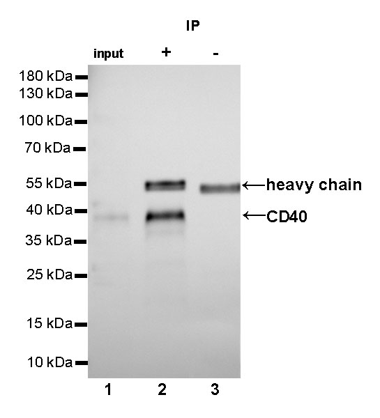 CD40 Recombinant Rabbit mAb (SDT-145-45)