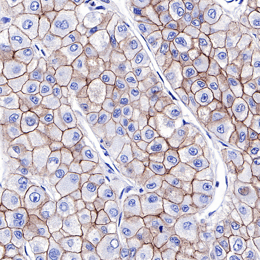 S Rmab® E Cadherin Recombinant Rabbit Mab Sdt R088p12830starter Bio 1159