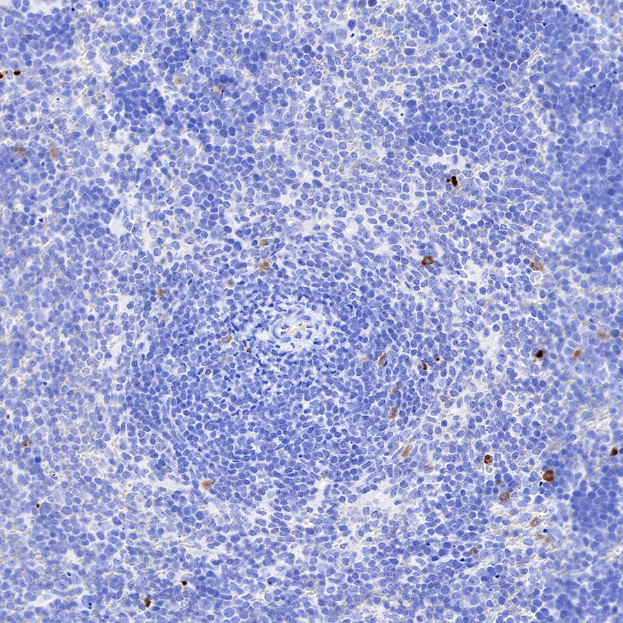 Cleaved PARP1 Recombinant Rabbit mAb,PBS Only (SDT-R084)