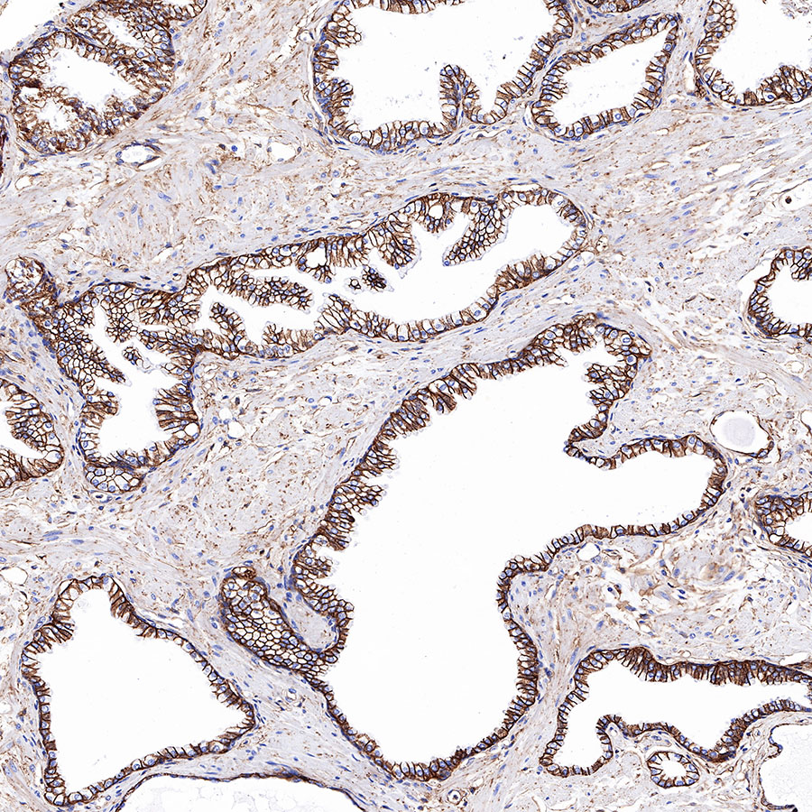 CD99 Recombinant Rabbit mAb (SDT-R122)