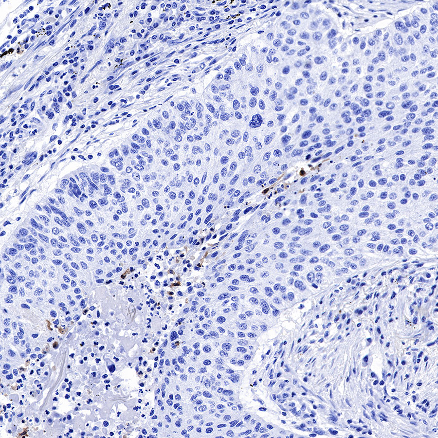 Cleaved PARP1 Recombinant Rabbit mAb,PBS Only (SDT-R084)