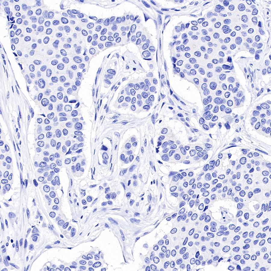 BSEP Recombinant Rabbit mAb (SDT-045-13)