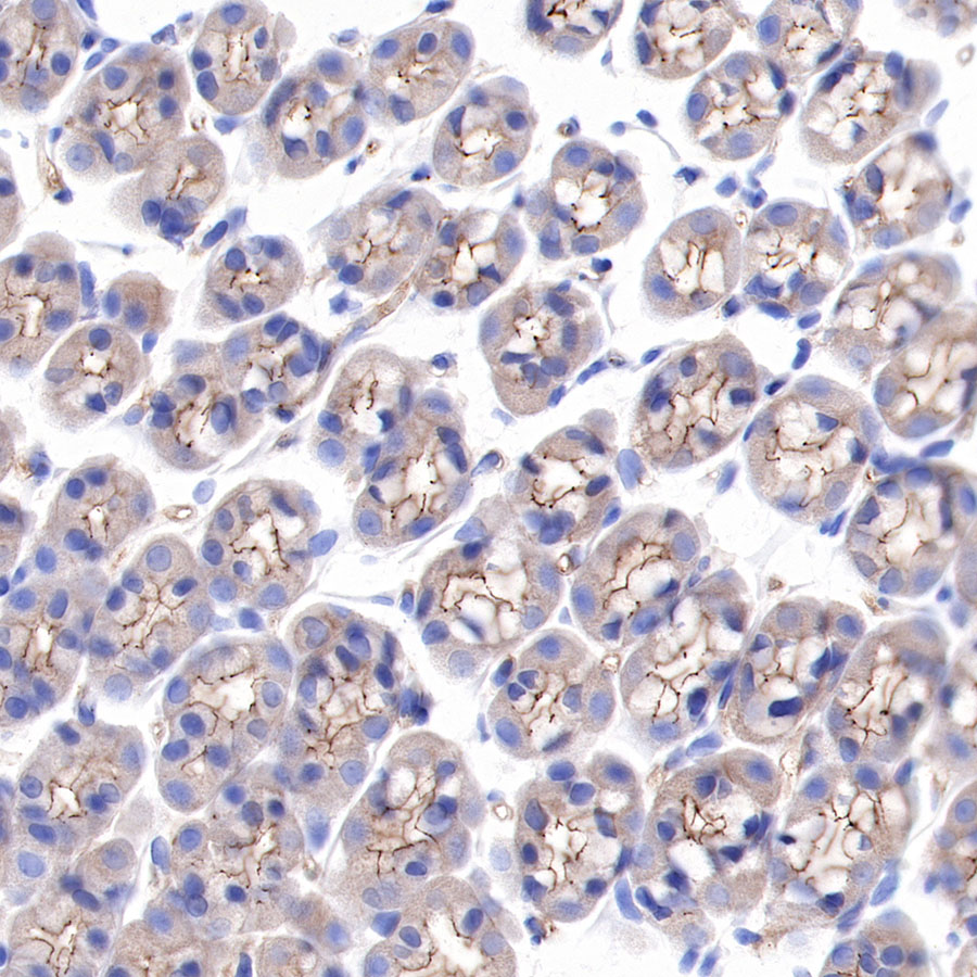 α-Actinin-1 Recombinant Rabbit mAb (SDT-311-20)