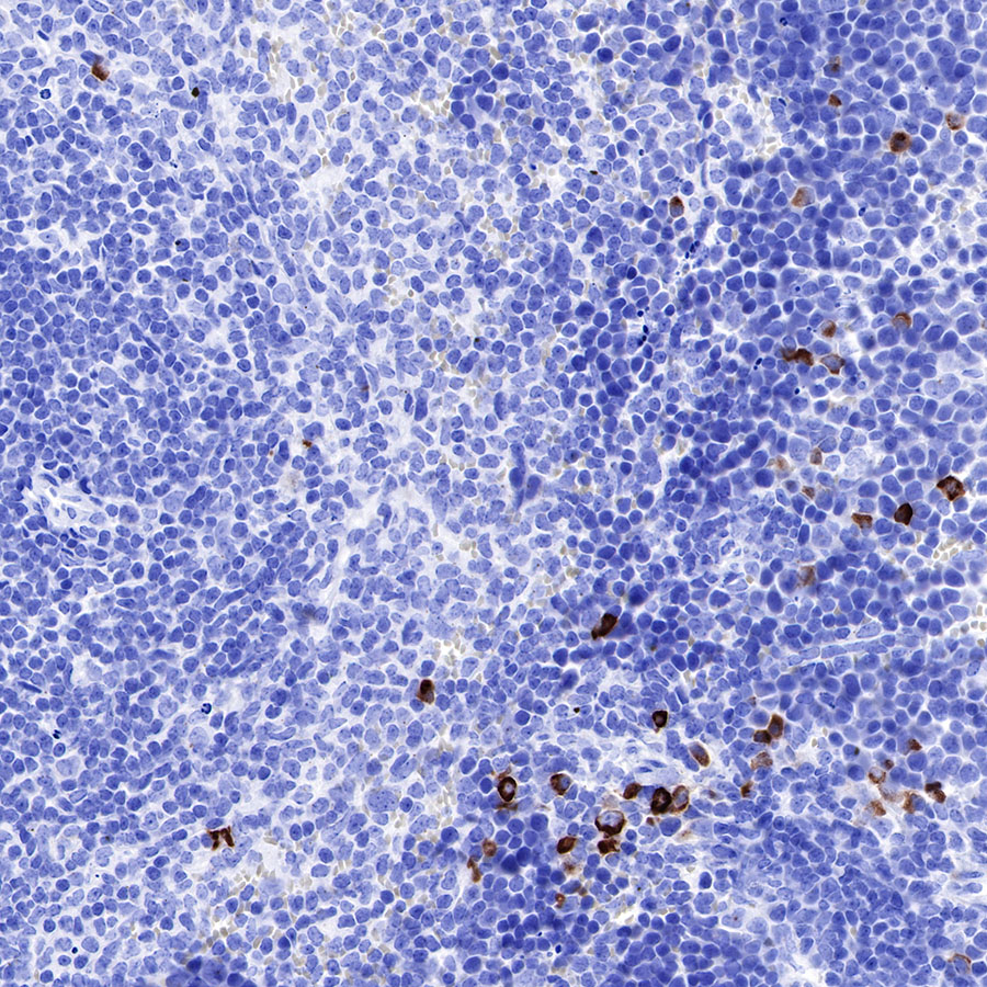 IGJ Recombinant Rabbit mAb (SDT-R128)