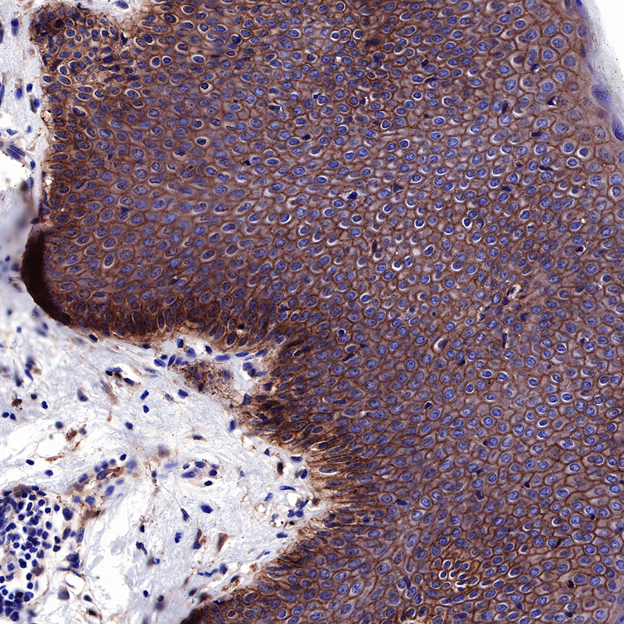 EGFR Recombinant Rabbit mAb (SDT-R110)