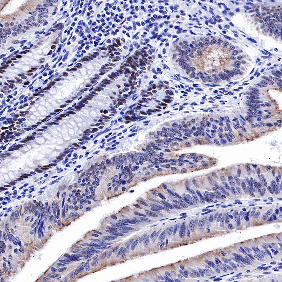 MSH2 Recombinant Rabbit mAb (SDT-037-20)