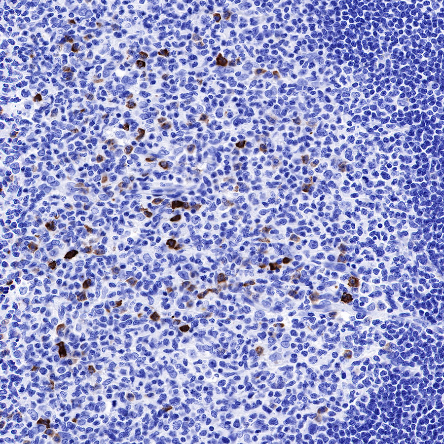 IGJ Recombinant Rabbit mAb (SDT-R128)