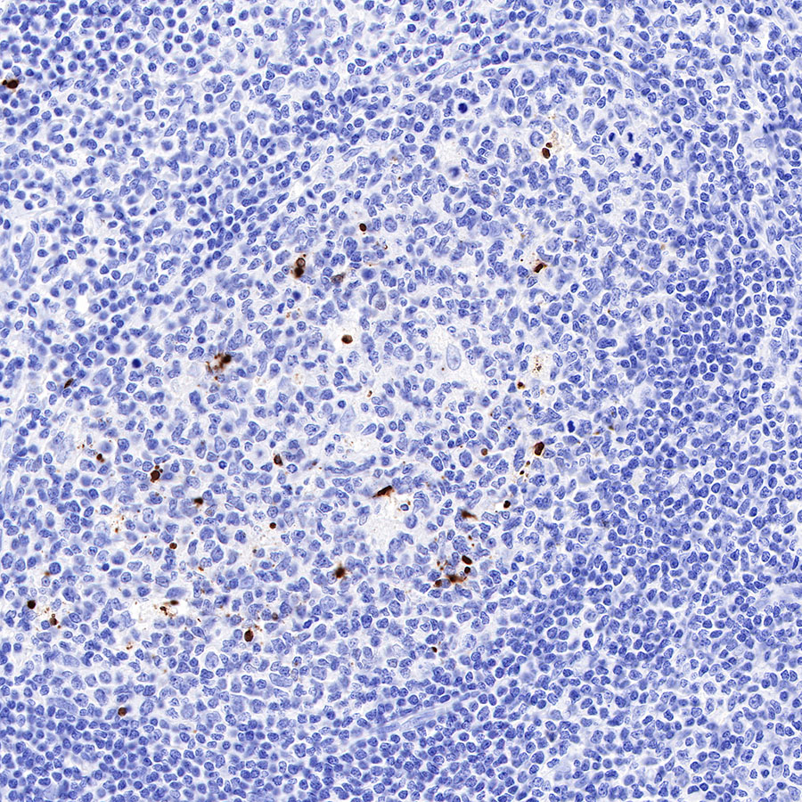 Cleaved PARP1 Recombinant Rabbit mAb,PBS Only (SDT-R084)