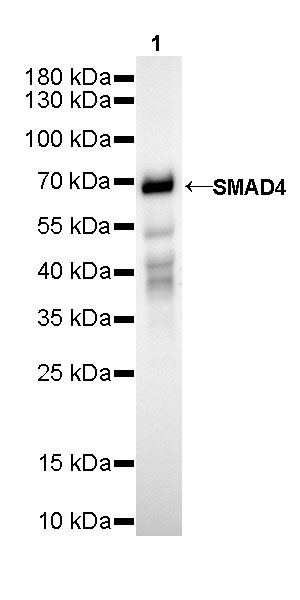 S-RMab® SMAD4 Recombinant Rabbit mAb (SDT-R114)