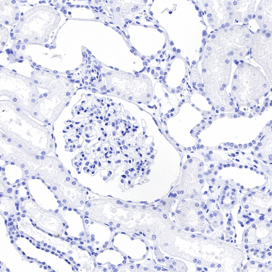 CD278/ICOS Recombinant Rabbit mAb (SDT-R104)