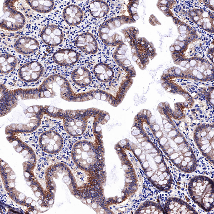 EGFR Recombinant Rabbit mAb (SDT-R110)