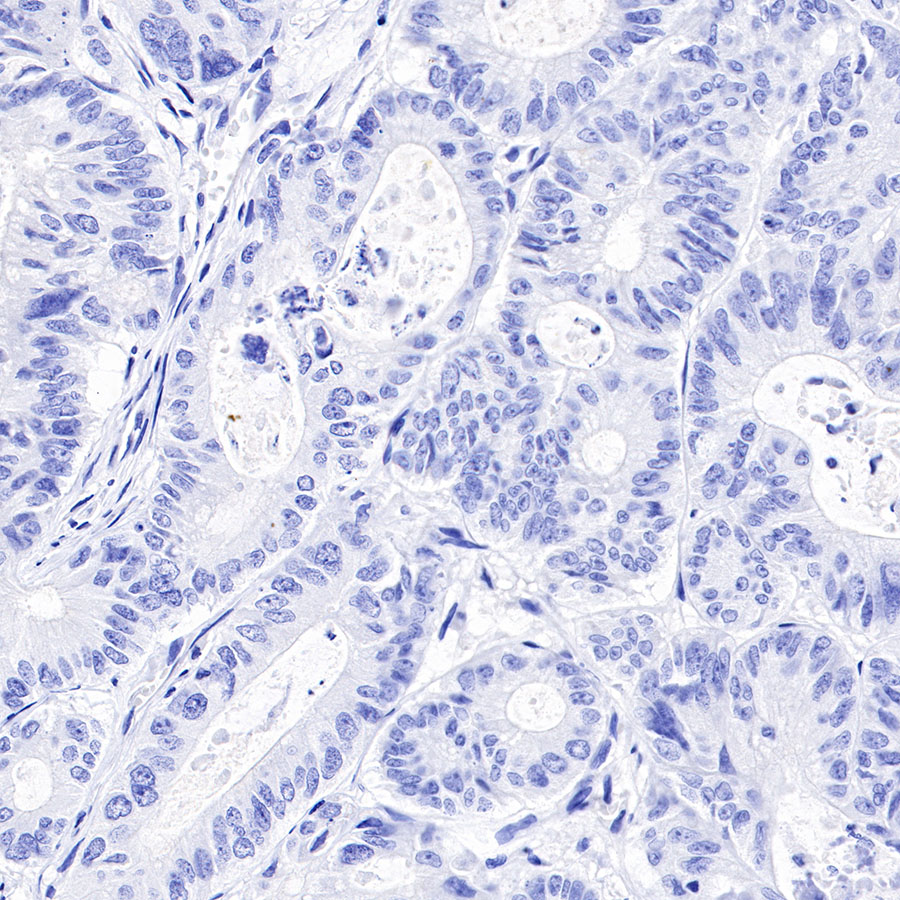 BSEP Recombinant Rabbit mAb (SDT-045-13)