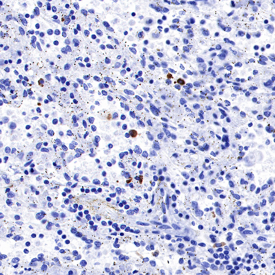 IGJ Recombinant Rabbit mAb (SDT-R128)