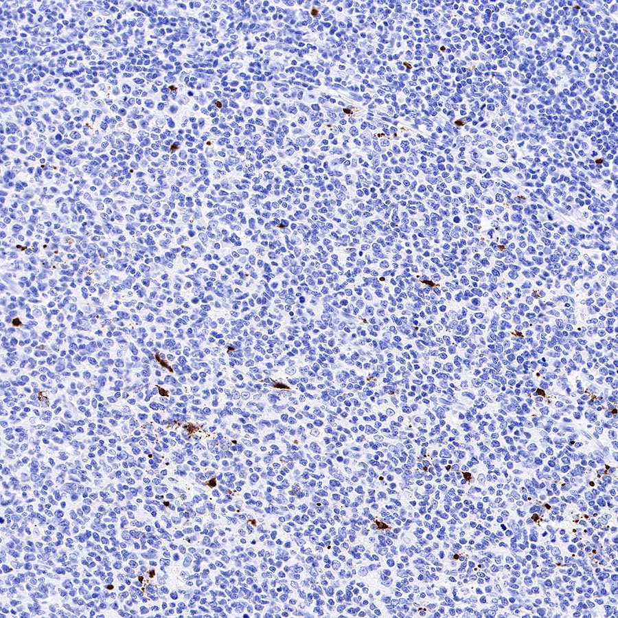 Cleaved PARP1 Recombinant Rabbit mAb,PBS Only (SDT-R084)