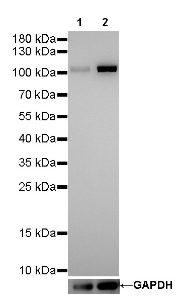 α-Actinin-1 Recombinant Rabbit mAb (SDT-311-20)